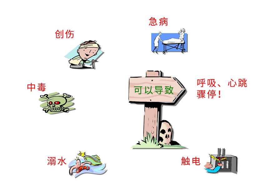 心脏骤停.jpg
