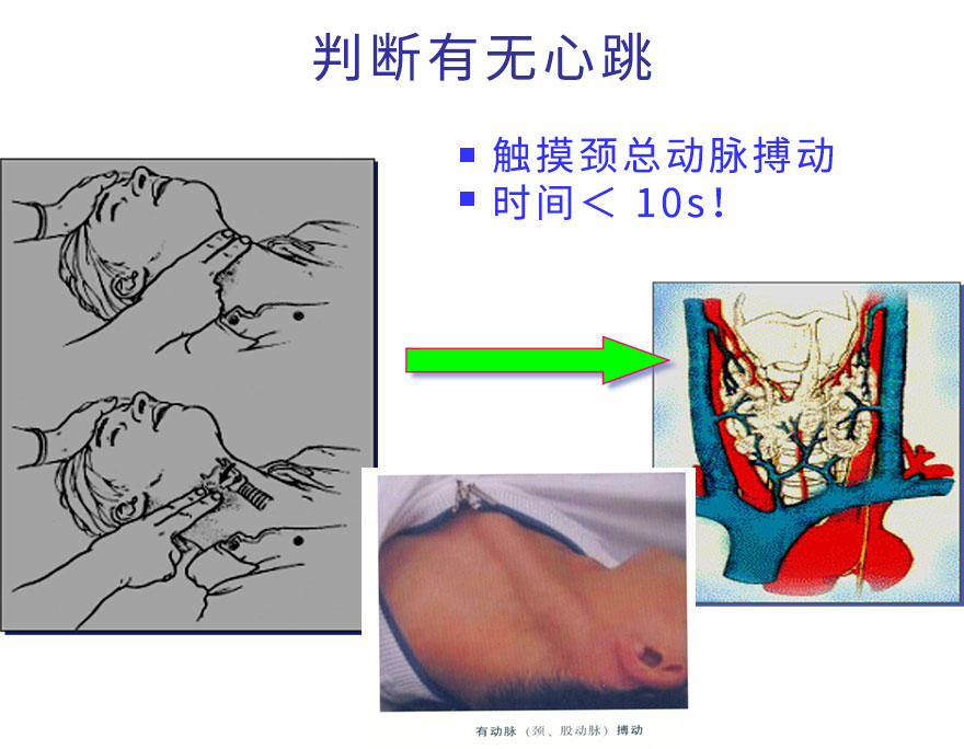 判断有无心跳.jpg