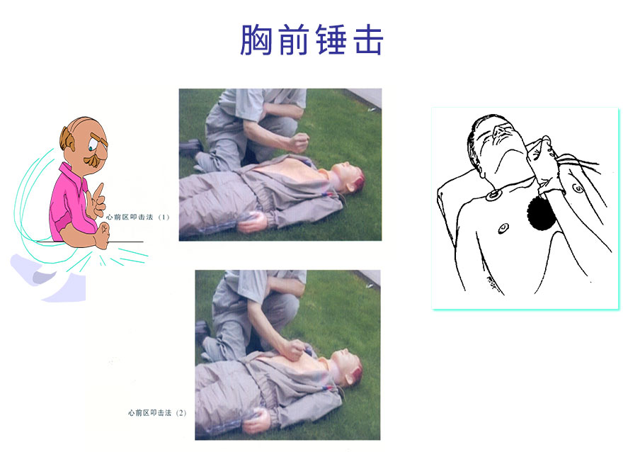 胸前锤击.jpg