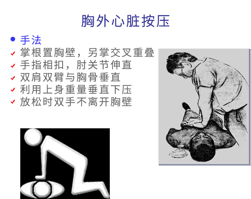 胸外心脏按压.jpg