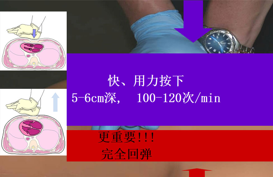胸外心脏按压4.jpg