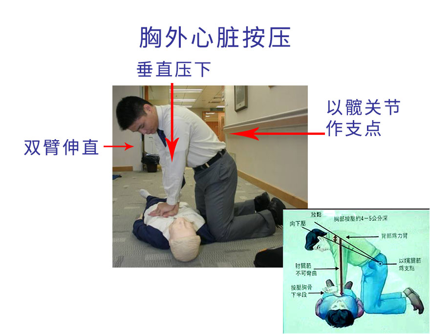 胸外心脏按压5.jpg