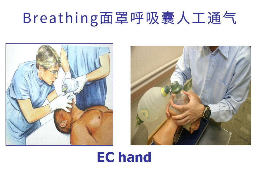 面罩呼吸囊人工呼吸.jpg