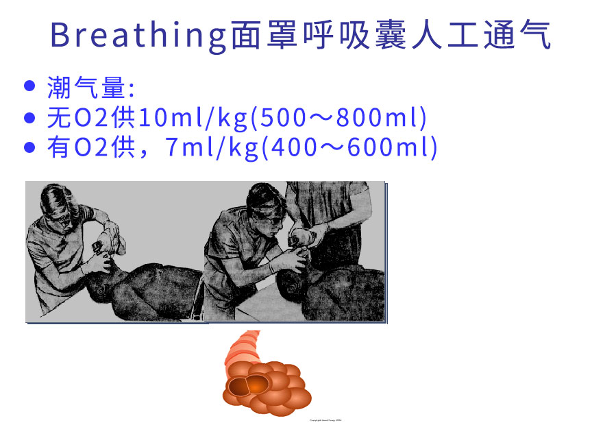 面罩呼吸囊人工通气.jpg