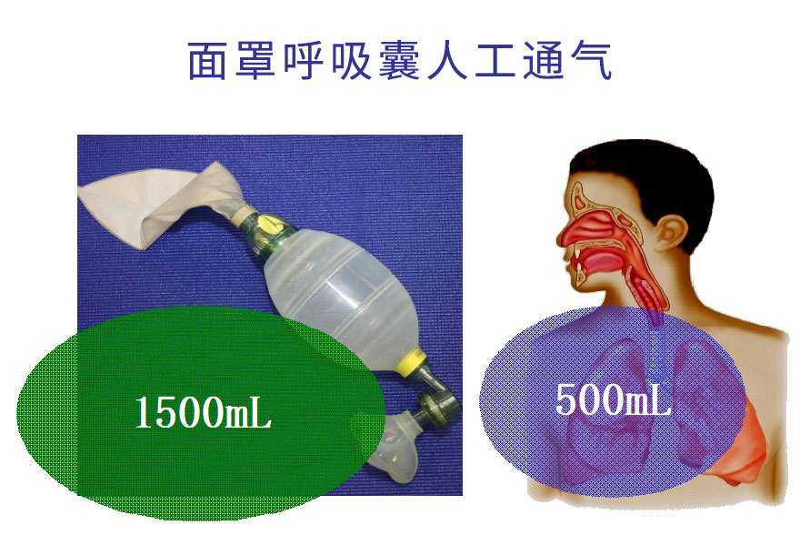 面罩呼吸囊人工通气3.jpg