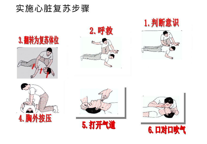实施心脏复苏步骤.jpg